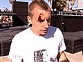 Ninja Warrior - American Ninja Warrior: Bloody Head Injury