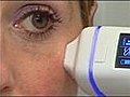 Health Watch: Getting Younger Skin With Home Laser Treatment