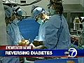 VIDEO: Gastric bypass and diabetes