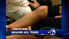 VIDEO: Treating ACL tears
