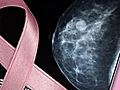 Mastectomy Options