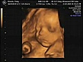 VARIOUS PICTURES FROM THE 4D ULTRASOUND CENTRE SM CEBU