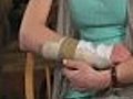 Med Science: Teen Has Arm Reattached After Boating Accident