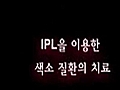 IPL씠젃寃 諛쏆쑝떆硫 옒 諛쏆 IPL엯땲떎..