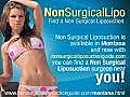 Non Surgical Liposuction Montana