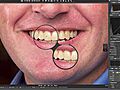 Aperture 3 Quick Tip Video: Whitening Teeth