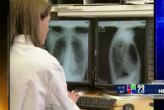 ¿Qué es la fibrosis pulmonar?