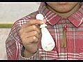 風船を膨らます滲出性中耳炎治療法