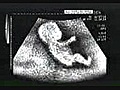 Amateur video - Driver kid