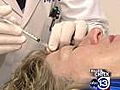 Botox a cure for migraines?