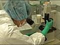 Using stem cells to save legs