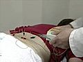 [Video] Acupuncture helps cancer patients