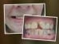 Can’t Afford Dental Work? Go Overseas