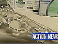 VIDEO: Ankle replacement surgery