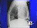 Man’s X-Ray Reveals Shocking Surprise