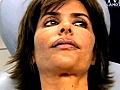 Lisa Rinna’s Lips Aren&#039;t Healing