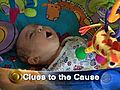 Clue Found To SIDS Deaths