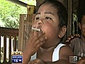 Smoking toddler quits smoking