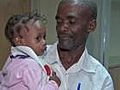 Haitian girl comes to Pa. for life-saving surgery