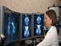 New Procedure Helps Detect Breast Cancer Tumors Faster