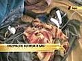 Encephalitis kills 20 children in Gaya