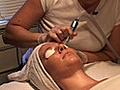 See a Microdermabrasion Treatment