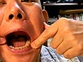 歯医者　動画