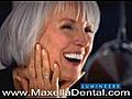 Lumineers Marina Del Rey Veneers Marina Del Rey Cosmetic Dentist