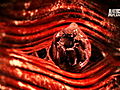 Monsters Inside Me: Worms Burrow Through Flesh