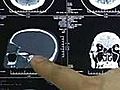 Chinese Man Finds Bullet In His Brain