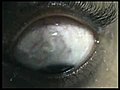 eyeball video