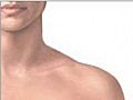 Brustkrebs Symptome