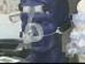 Sleep Apnea Could Be Life Or Death Problem