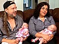 Surgery in womb saves twins