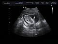 15W5D