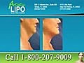 Tumescent Liposuction in Tampa – Chin,  Neck & Jowl Area