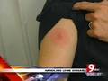 Family Healthcast: Handling Lyme Disease 7/7/08