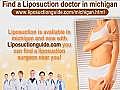 Liposuction Michigan