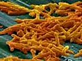 Deadly bacteria on the rise