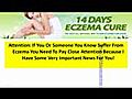 14 Days Eczema Cure - The Safe And Natural Way To Cure Eczema