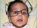 Bebeklerde göz tembelliği nasıl anlaşılır?
