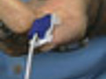 VENDYS Fingertip Blood Pressure Test