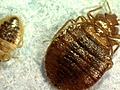Superbug Germ Detected in Bedbugs