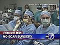 VIDEO: A new weight loss surgery