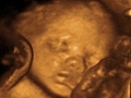 Hamileligin 29. haftasinda bebegin durumu nasildir?