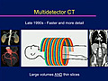 What are the Risks and Benefits of Lung,  Cardiac and Colon Screening with CT?