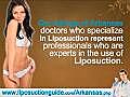 Liposuction Arkansas