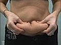 Tips to Reduce Visceral Belly Fat