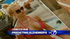 VIDEO: New insights into Alzheimer’s