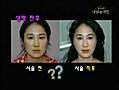 [이지리프트]_미라클 성형외과 우정호 원장의 미라클 리프트 소개, 갸름한 얼굴의 이지리프트, 주름,팔자주름, 리프팅, v라인